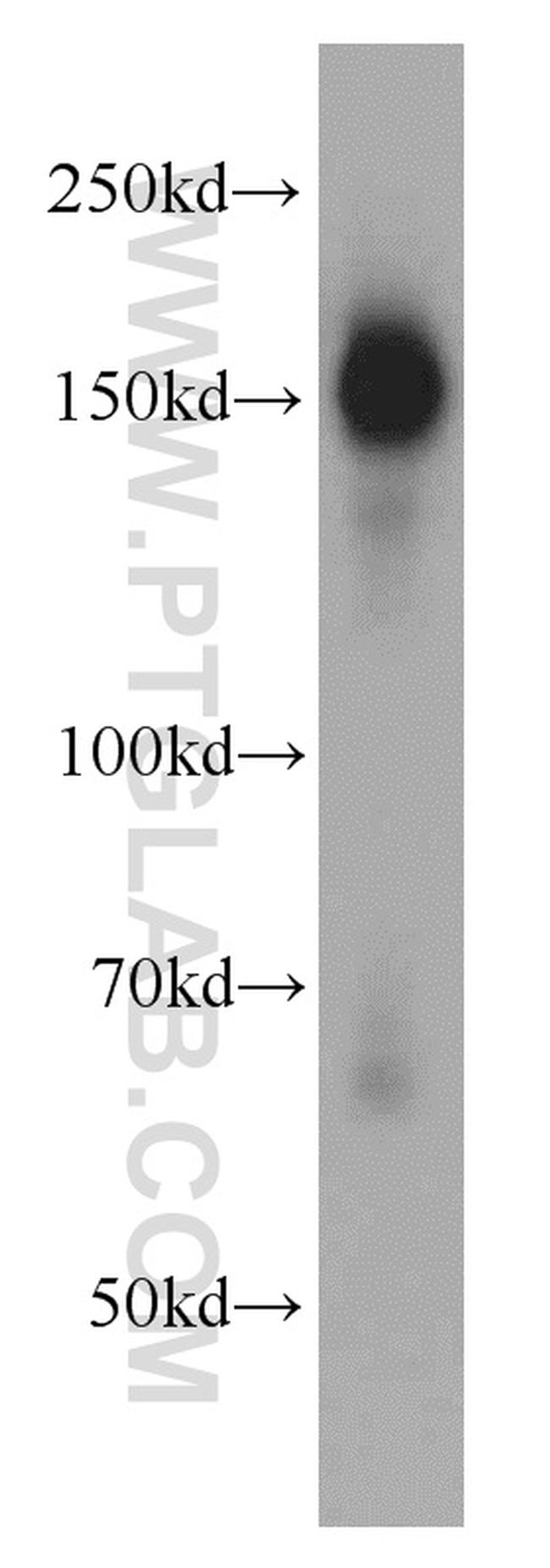 ROCK2(middle) Antibody in Western Blot (WB)