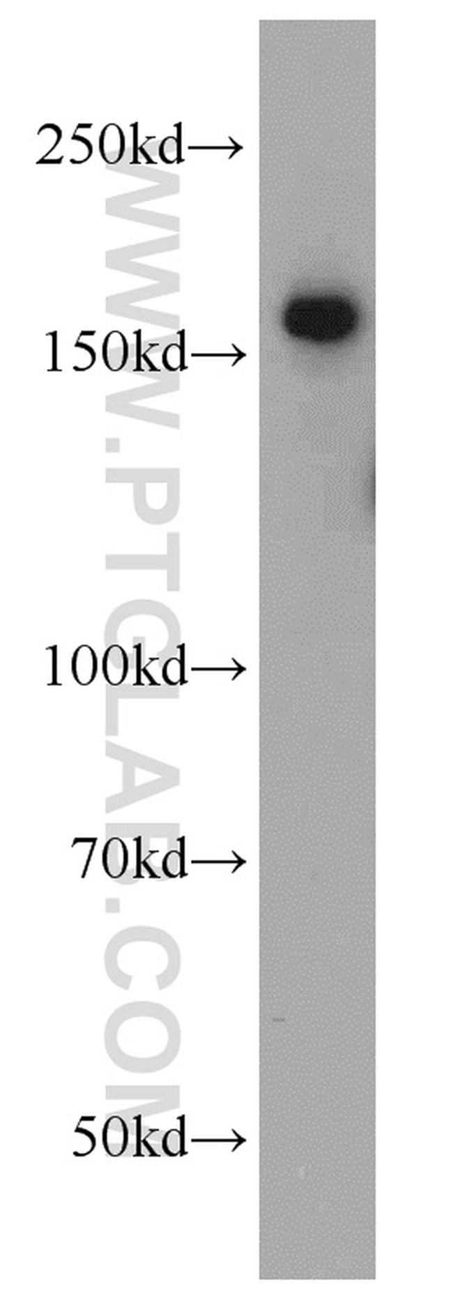 ROCK2(middle) Antibody in Western Blot (WB)