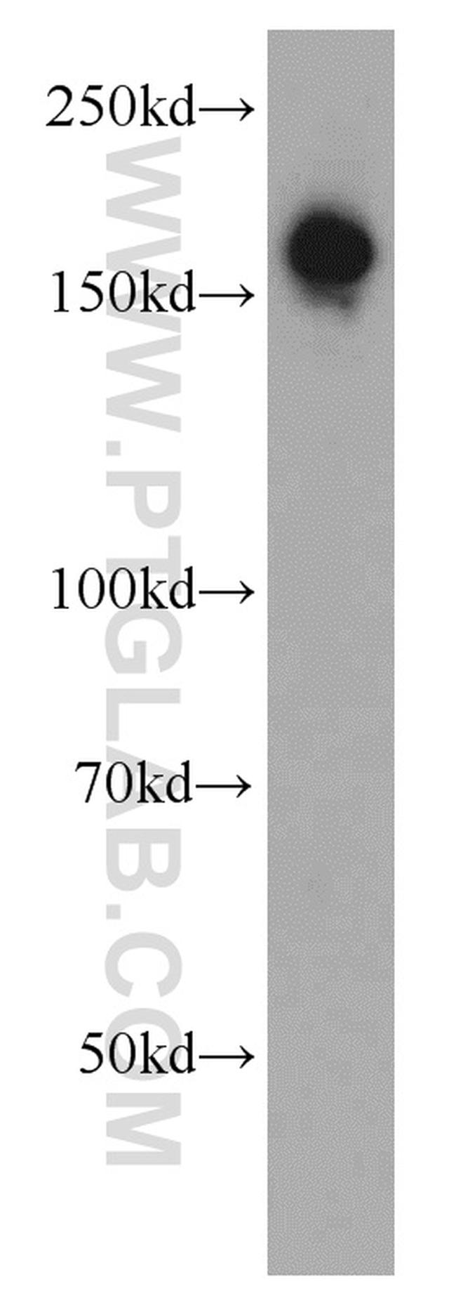 ROCK2(middle) Antibody in Western Blot (WB)