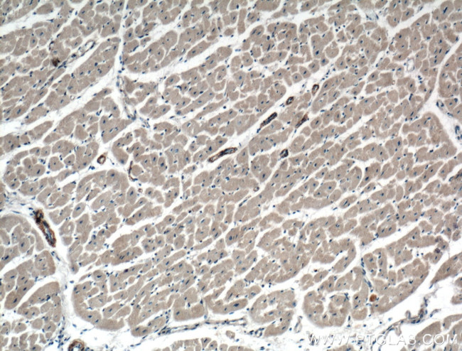 PRKG1 Antibody in Immunohistochemistry (Paraffin) (IHC (P))