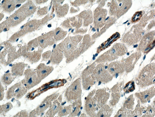 PRKG1 Antibody in Immunohistochemistry (Paraffin) (IHC (P))