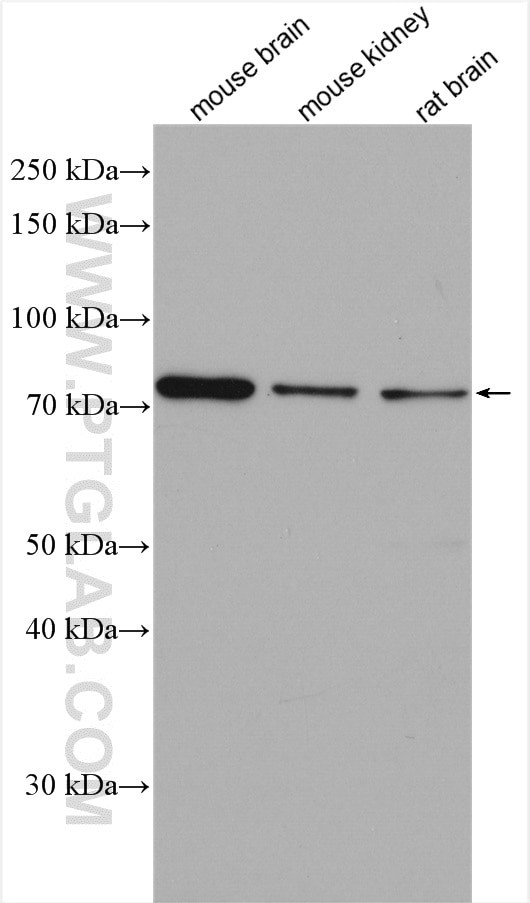 PRKG1 Antibody in Western Blot (WB)