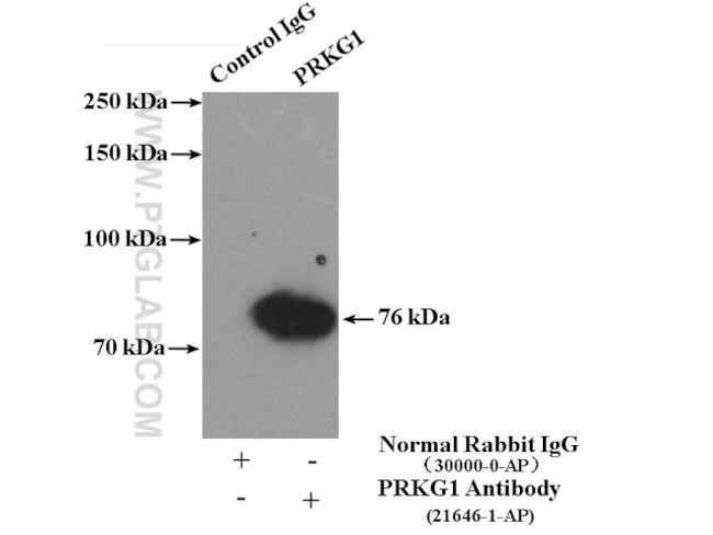 PRKG1 Antibody in Immunoprecipitation (IP)