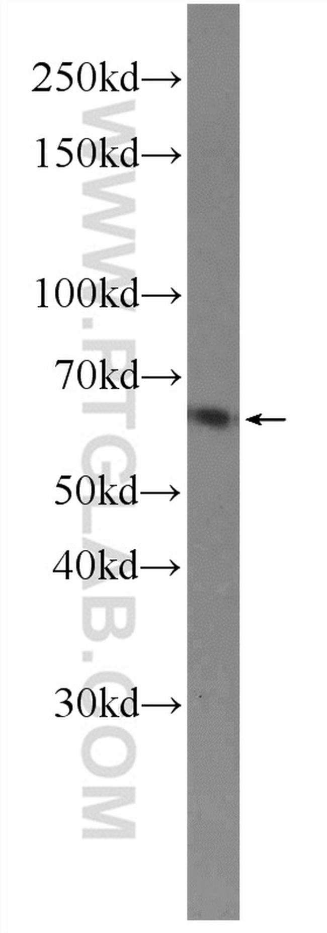 PRKG1 Antibody in Western Blot (WB)