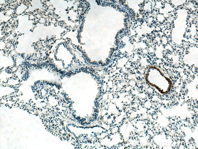 Cardiac Troponin I Antibody in Immunohistochemistry (Paraffin) (IHC (P))