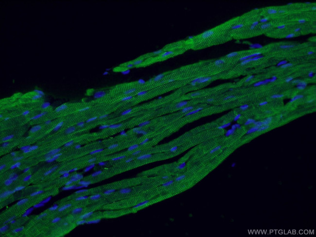 Cardiac Troponin I Antibody in Immunohistochemistry (PFA fixed) (IHC (PFA))