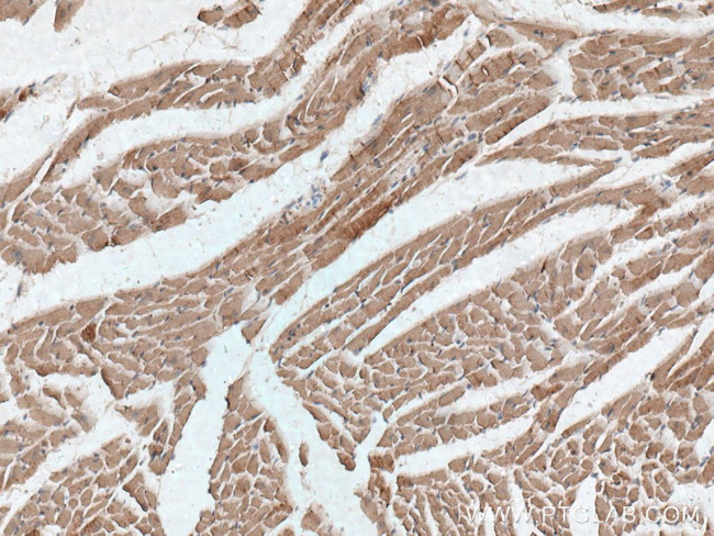 Cardiac Troponin I Antibody in Immunohistochemistry (Paraffin) (IHC (P))