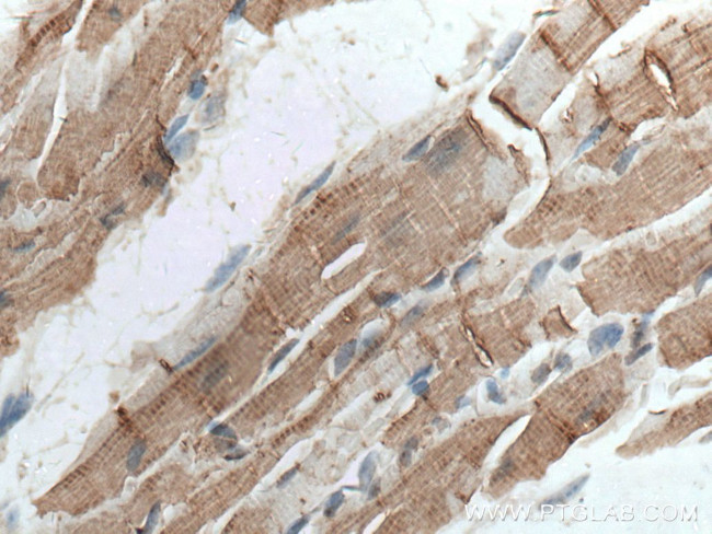 Cardiac Troponin I Antibody in Immunohistochemistry (Paraffin) (IHC (P))