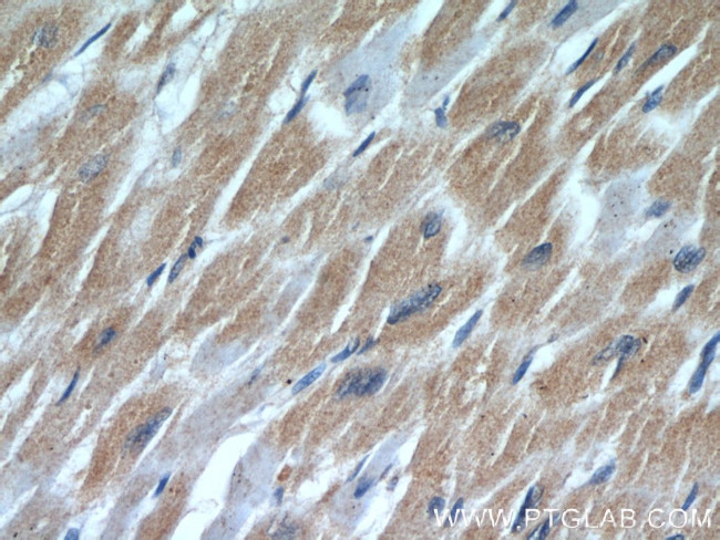 Cardiac Troponin I Antibody in Immunohistochemistry (Paraffin) (IHC (P))