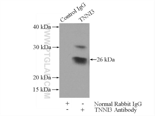 Cardiac Troponin I Antibody in Immunoprecipitation (IP)