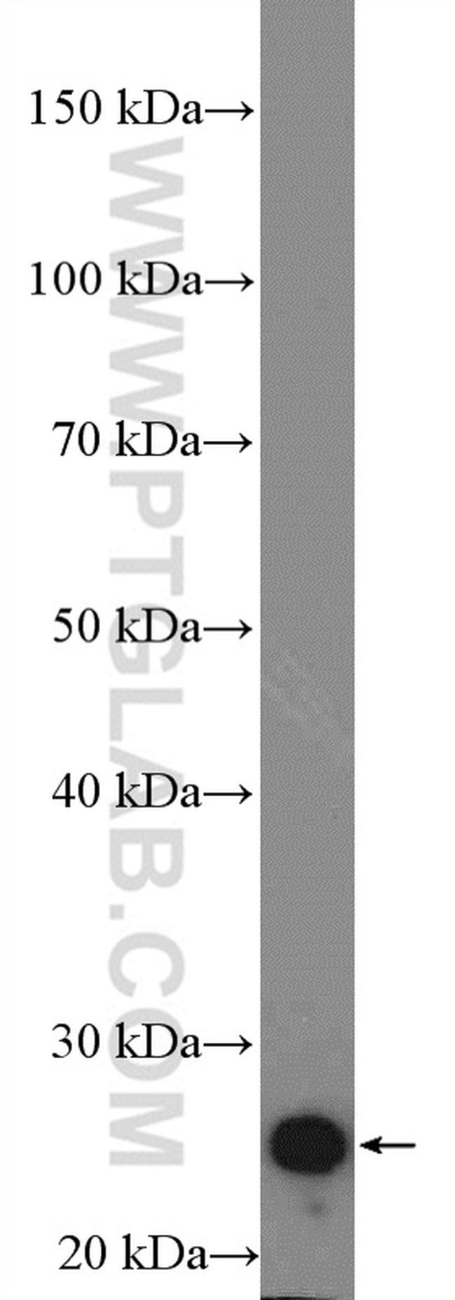 Cardiac Troponin I Antibody in Western Blot (WB)