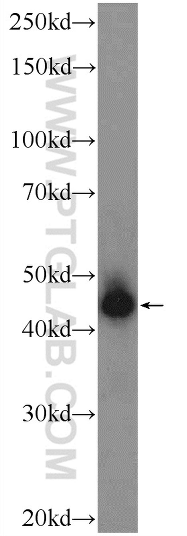 HOXB1 Antibody in Western Blot (WB)