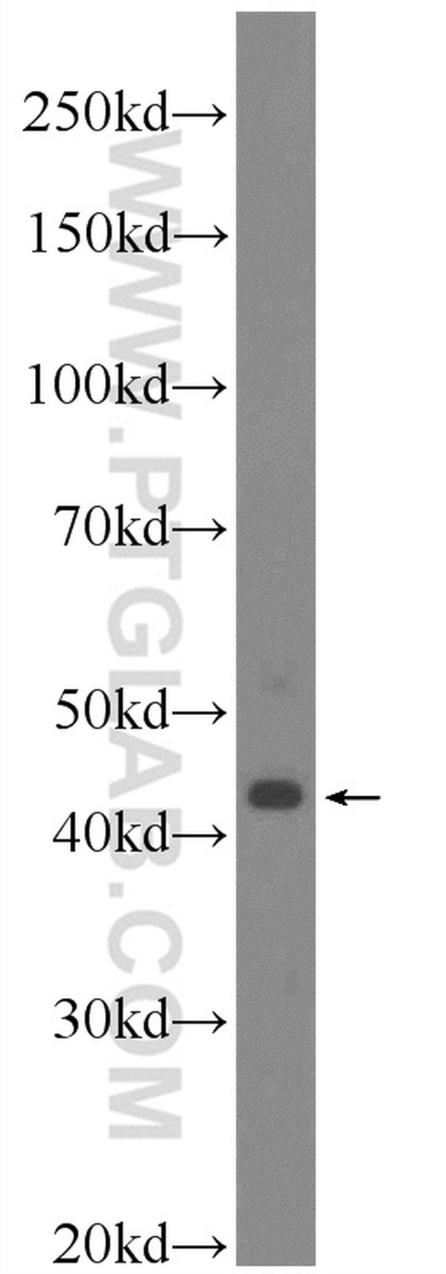 HOXB1 Antibody in Western Blot (WB)