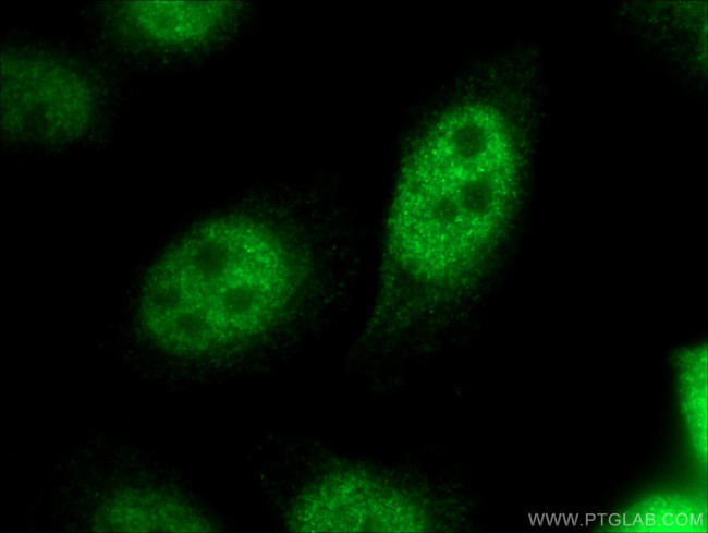 CDX1 Antibody in Immunocytochemistry (ICC/IF)