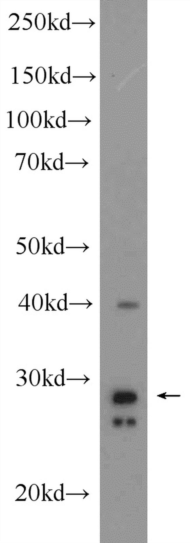 CDX1 Antibody in Western Blot (WB)