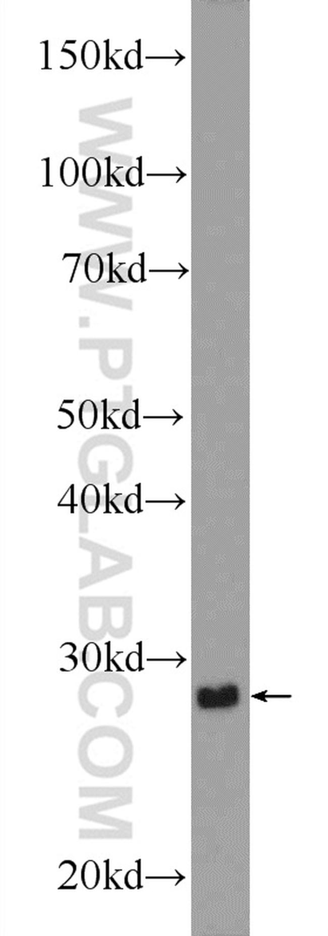 CDX1 Antibody in Western Blot (WB)