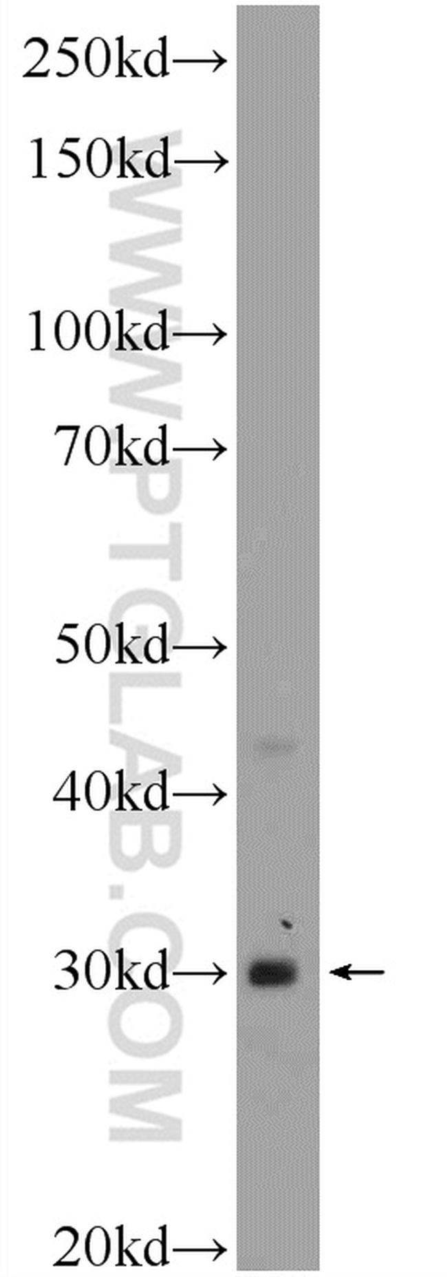 CDX1 Antibody in Western Blot (WB)