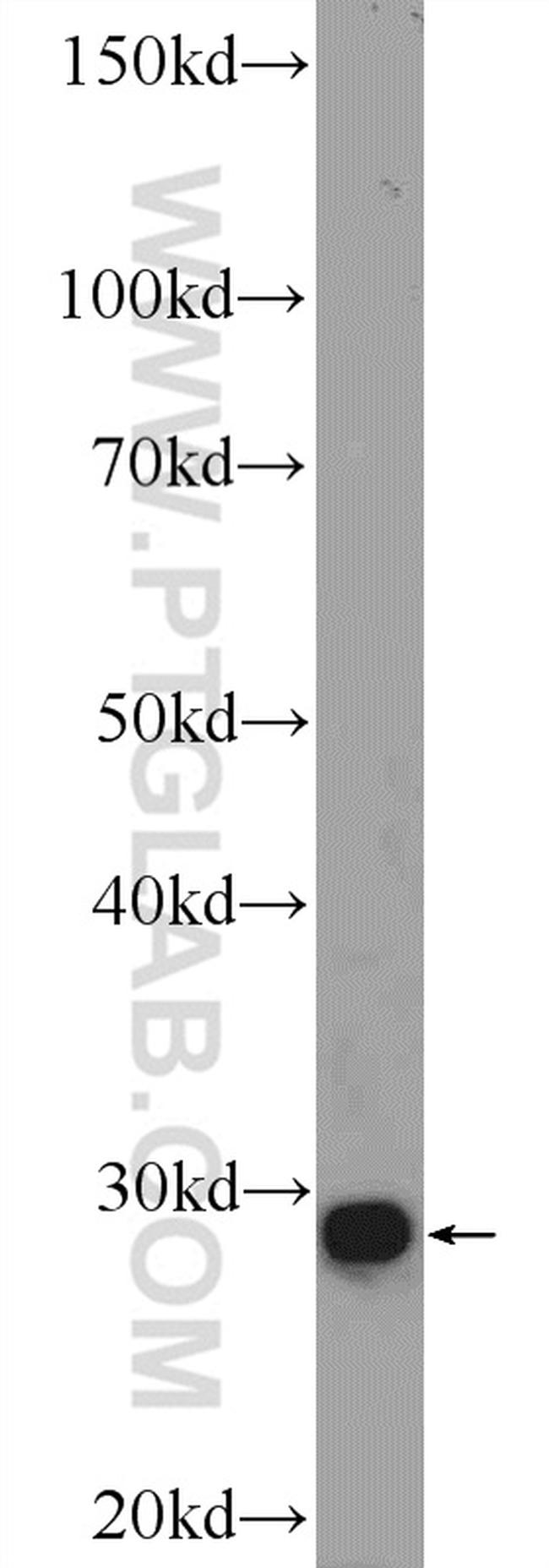 CDX1 Antibody in Western Blot (WB)