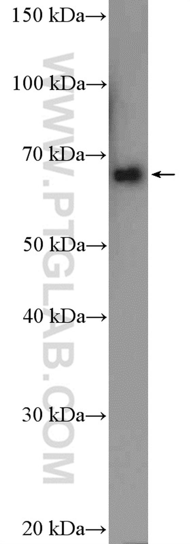 KCNA5 Antibody in Western Blot (WB)