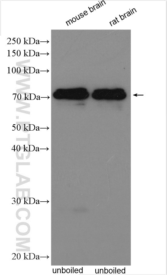 KCNA5 Antibody in Western Blot (WB)