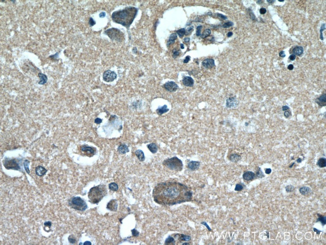 RAB3GAP1 Antibody in Immunohistochemistry (Paraffin) (IHC (P))