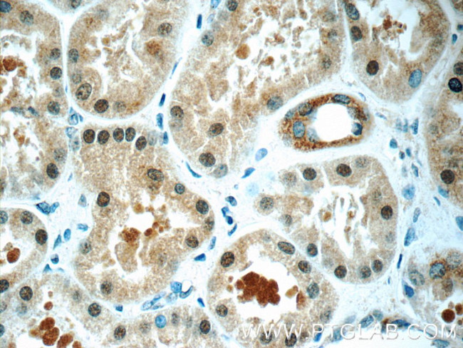 RAB3GAP1 Antibody in Immunohistochemistry (Paraffin) (IHC (P))