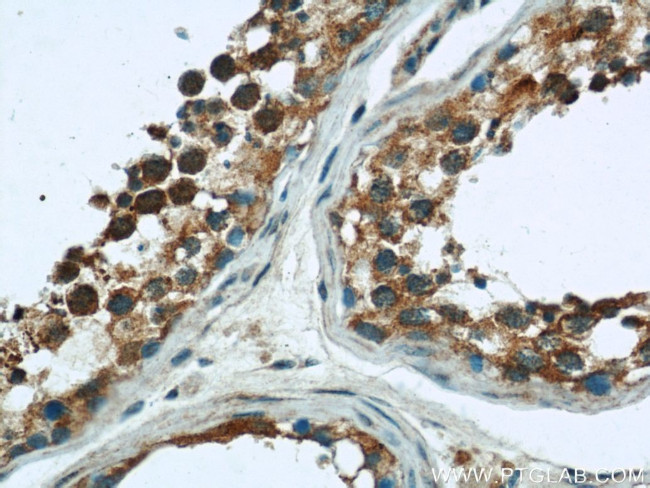 RAB3GAP1 Antibody in Immunohistochemistry (Paraffin) (IHC (P))