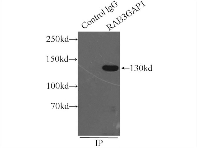 RAB3GAP1 Antibody in Immunoprecipitation (IP)