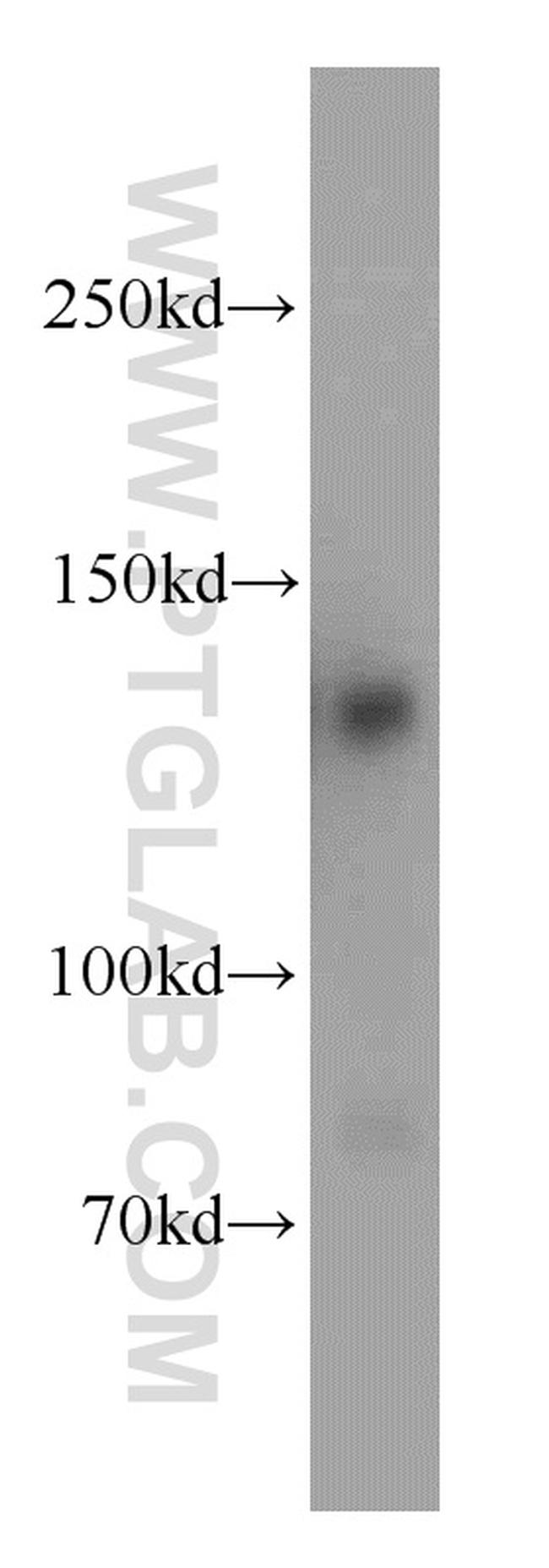 RAB3GAP1 Antibody in Western Blot (WB)