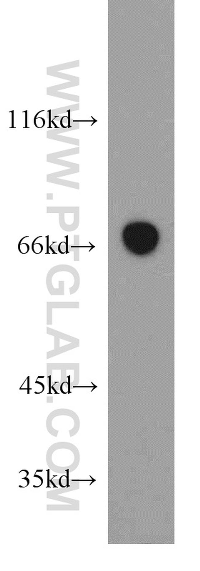 SESN1 Antibody in Western Blot (WB)