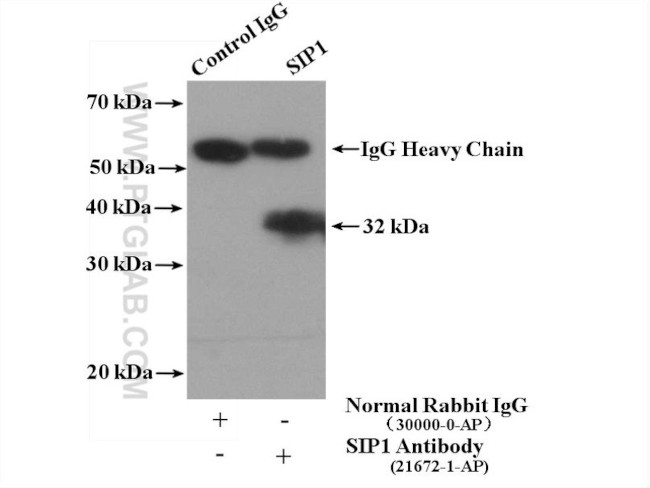 SIP1 Antibody in Immunoprecipitation (IP)