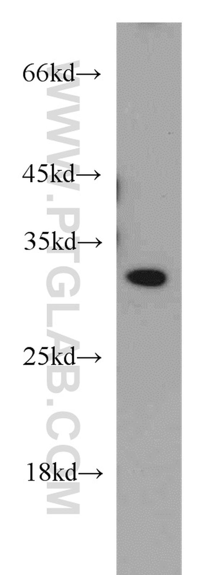 SIP1 Antibody in Western Blot (WB)