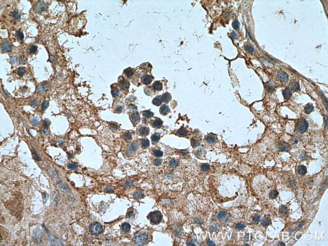 NANOS3 Antibody in Immunohistochemistry (Paraffin) (IHC (P))