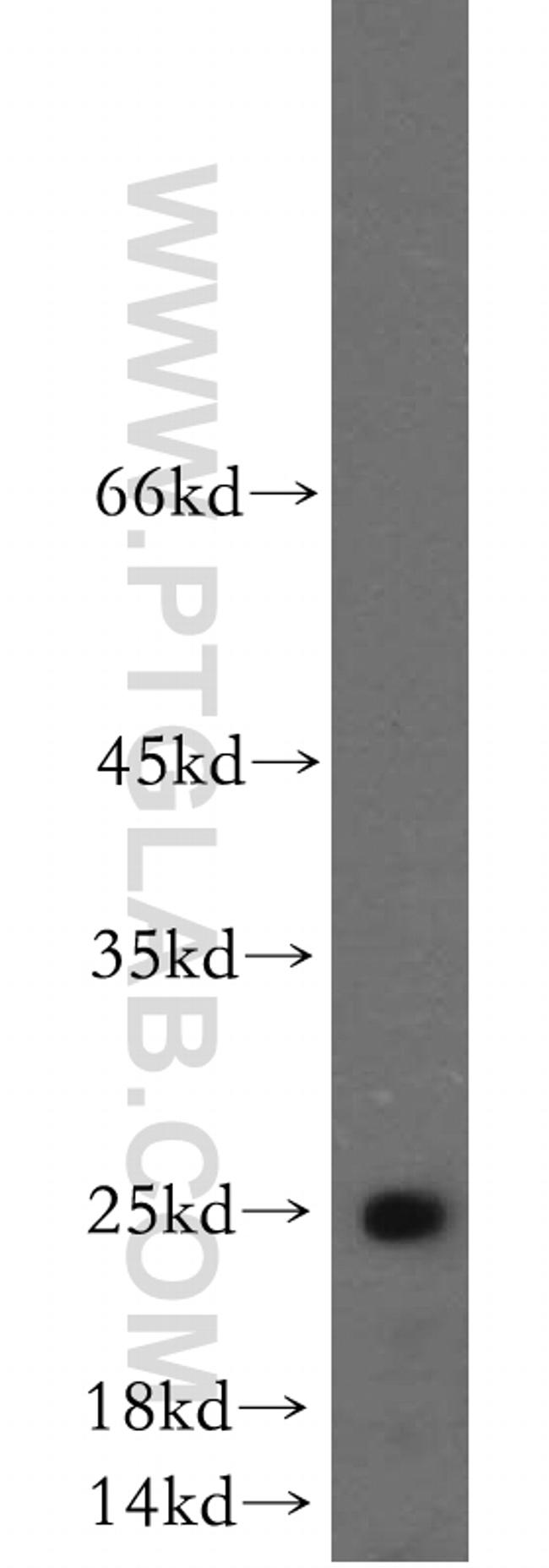 NANOS3 Antibody in Western Blot (WB)