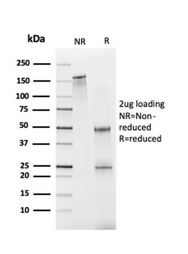 Fatty Acid Binding Protein (Liver)/FABP1 Antibody in Immunoelectrophoresis (IE)