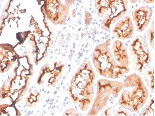 Fatty Acid Binding Protein (Liver)/FABP1 Antibody in Immunohistochemistry (Paraffin) (IHC (P))