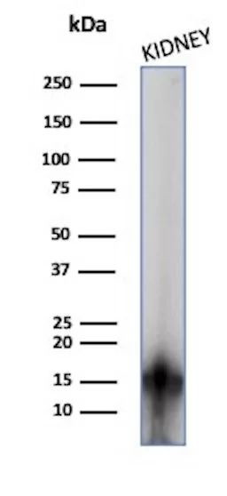 Fatty Acid Binding Protein (Liver)/FABP1 Antibody in Western Blot (WB)