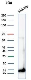 Fatty Acid Binding Protein (Liver)/FABP1 Antibody in Western Blot (WB)