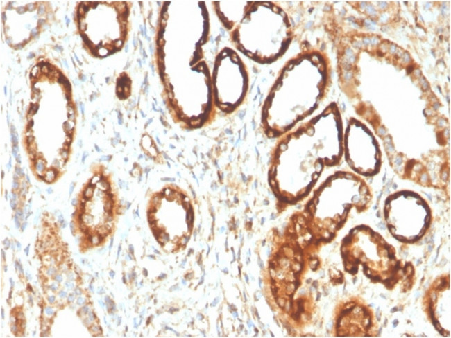 Fatty Acid Binding Protein (Liver)/FABP1 Antibody in Immunohistochemistry (Paraffin) (IHC (P))