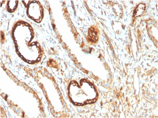 Fatty Acid Binding Protein (Liver)/FABP1 Antibody in Immunohistochemistry (Paraffin) (IHC (P))