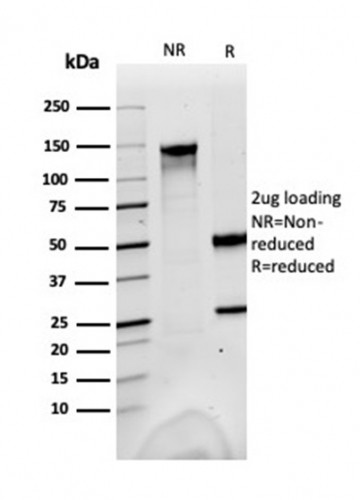 Fatty Acid Binding Protein (Liver)/FABP1 Antibody in SDS-PAGE (SDS-PAGE)