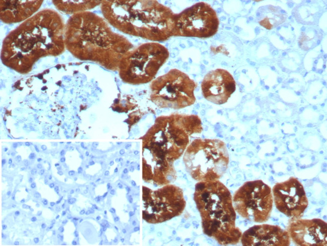 Fatty Acid Binding Protein (Liver)/FABP1 Antibody in Immunohistochemistry (Paraffin) (IHC (P))