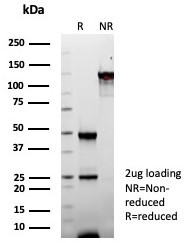 Fatty Acid Binding Protein (Liver)/FABP1 Antibody in SDS-PAGE (SDS-PAGE)