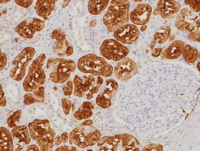 Fatty Acid Binding Protein (Liver)/FABP1 Antibody in Immunohistochemistry (Paraffin) (IHC (P))