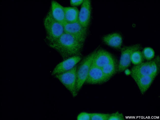 NF2 Antibody in Immunocytochemistry (ICC/IF)