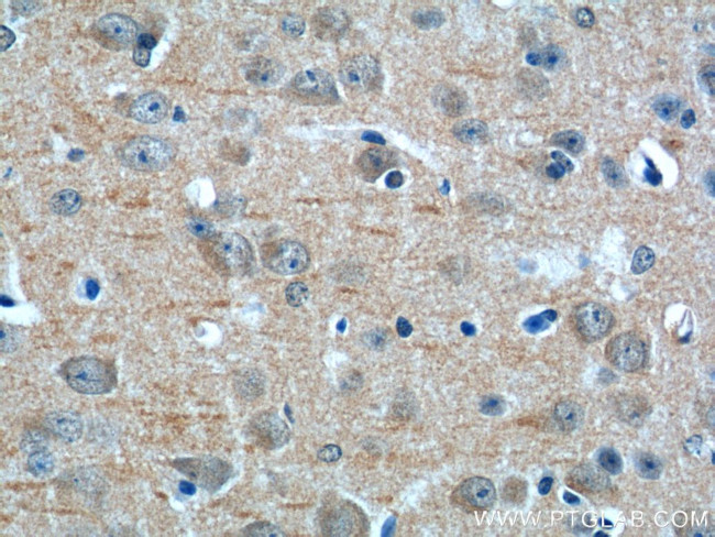 NF2 Antibody in Immunohistochemistry (Paraffin) (IHC (P))