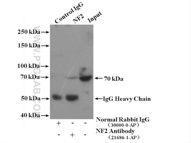 NF2 Antibody in Immunoprecipitation (IP)