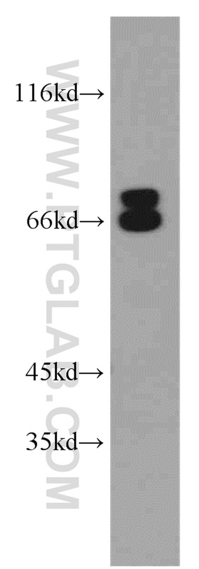 NF2 Antibody in Western Blot (WB)