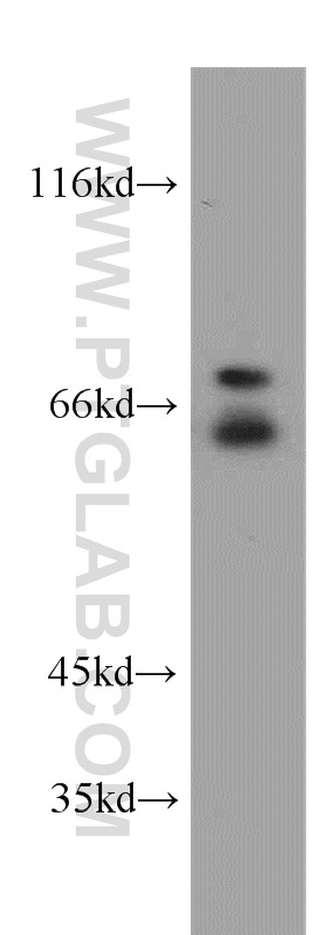 NF2 Antibody in Western Blot (WB)