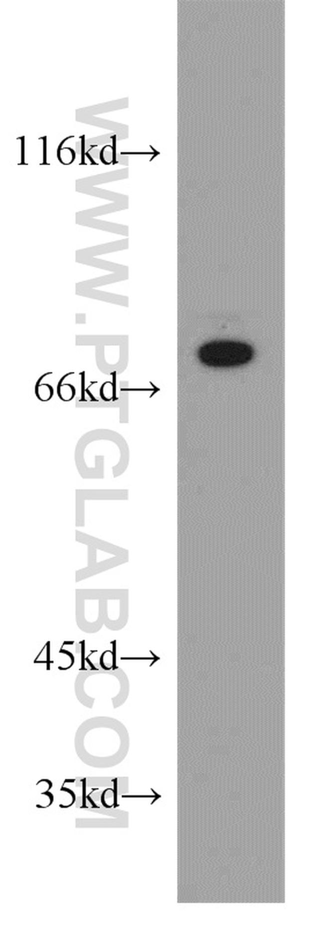 NF2 Antibody in Western Blot (WB)